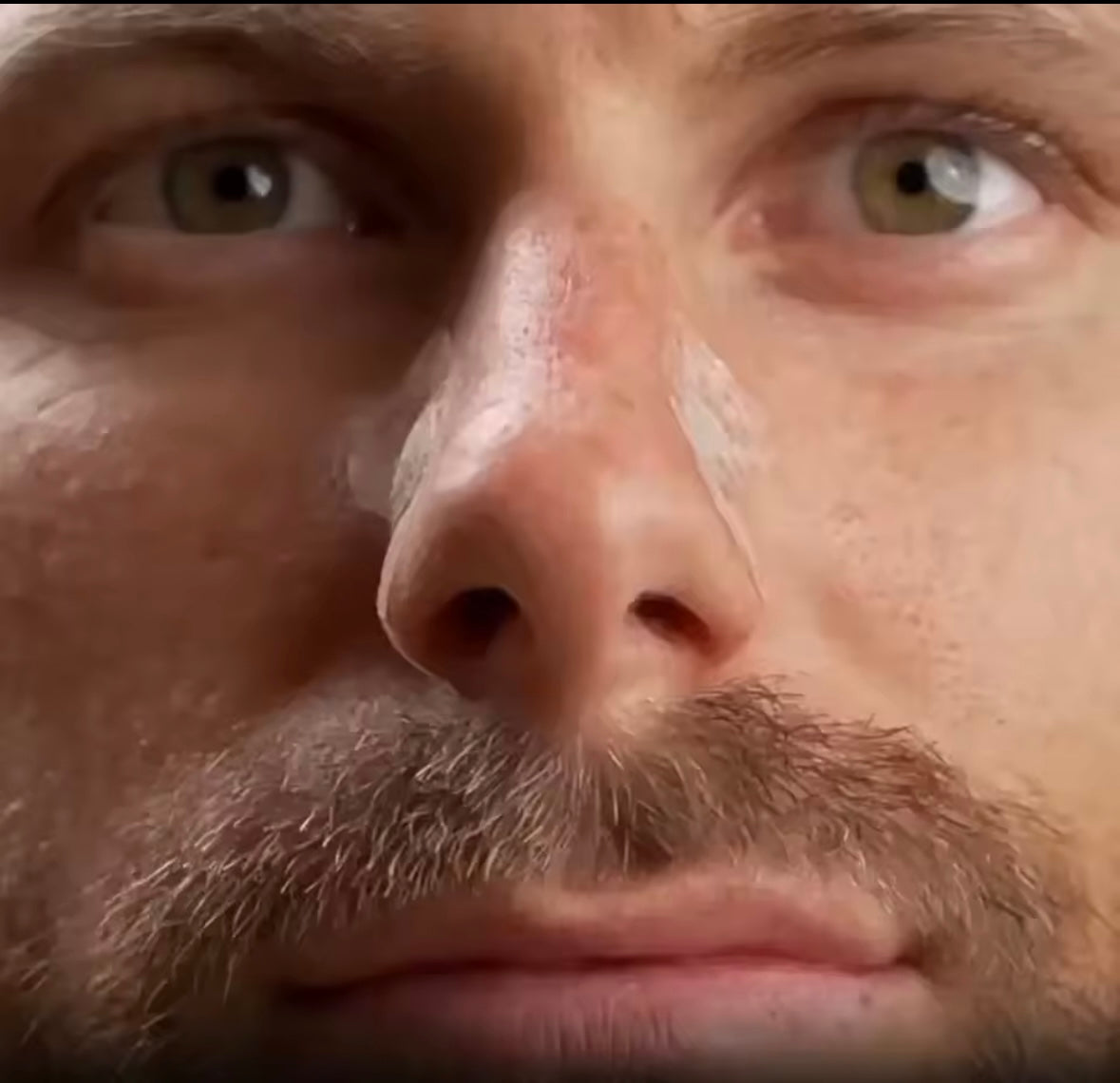 Premier Nasal Dilator - Black Starter Kit